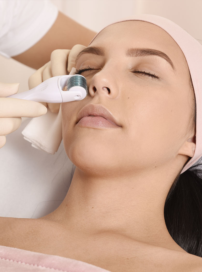 microneedling